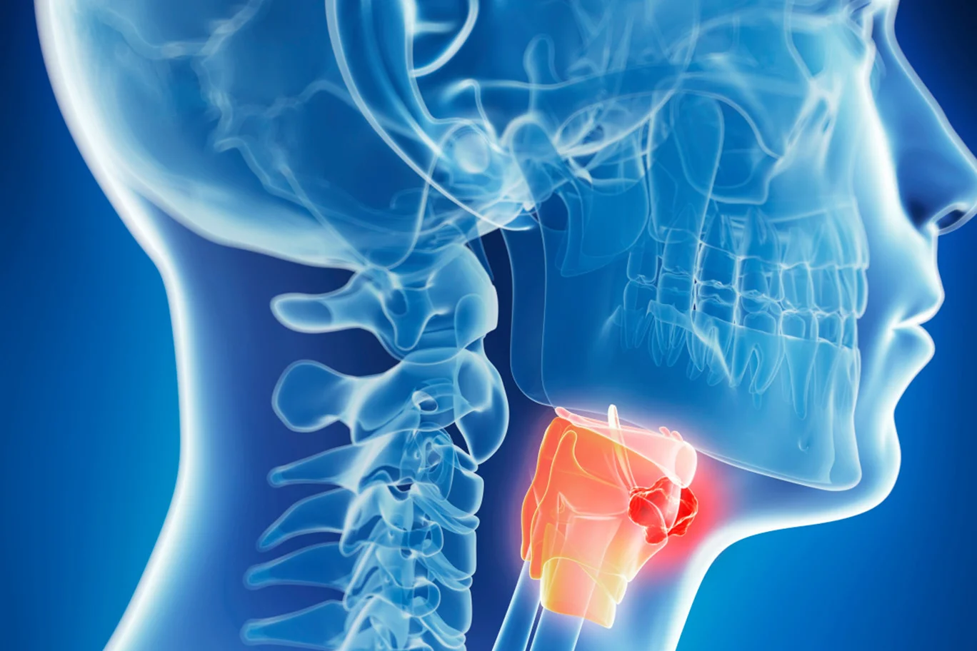 Baş ve Boyun Kanserleri